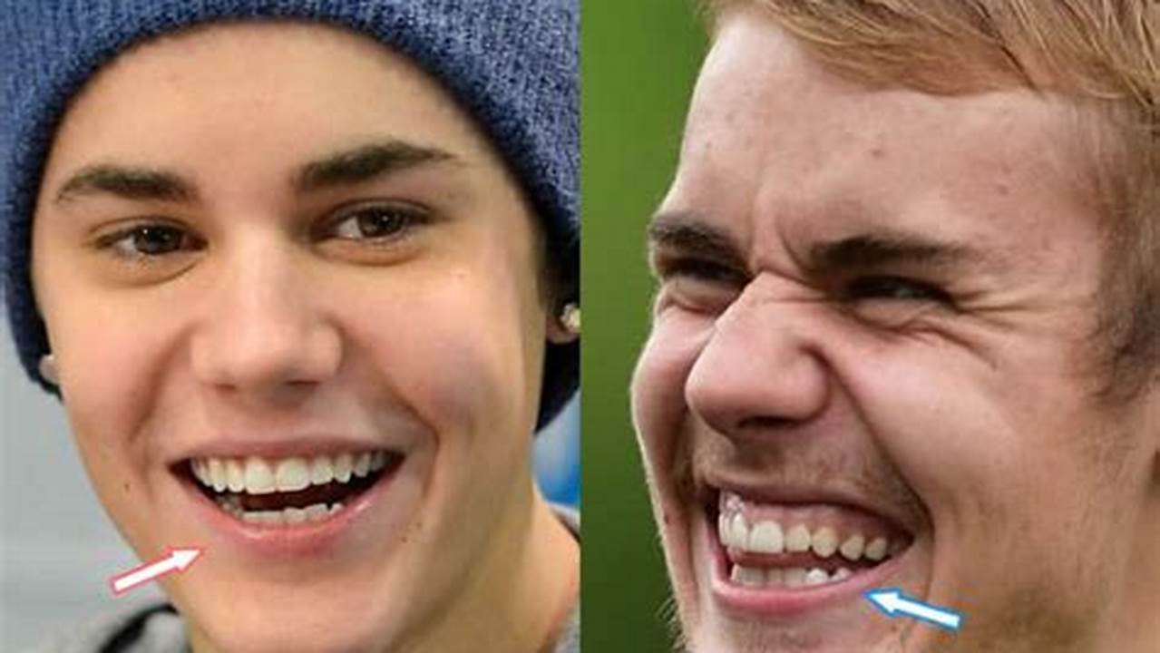 Justin Bieber Teeth 2024 Pictures