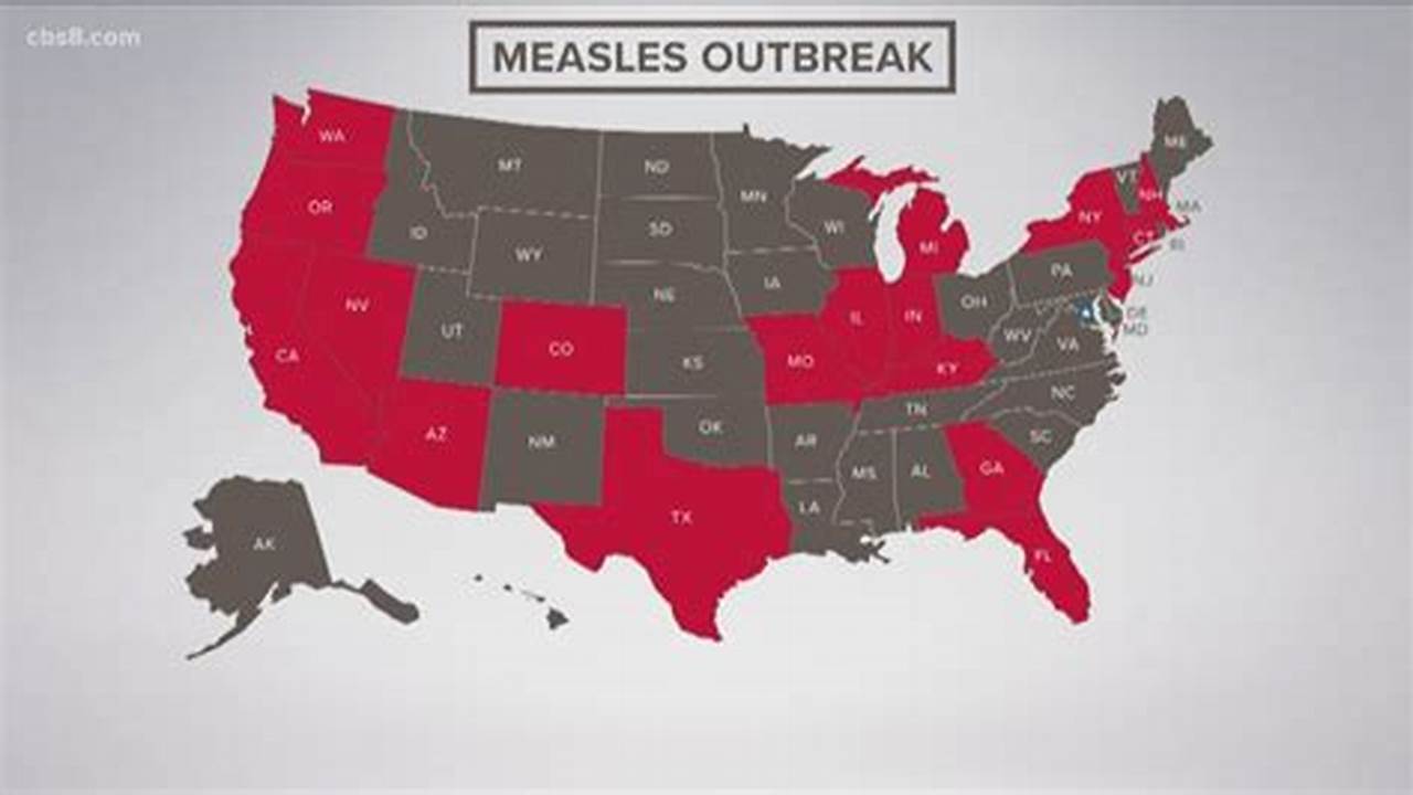 Measles Outbreak 2024 United States