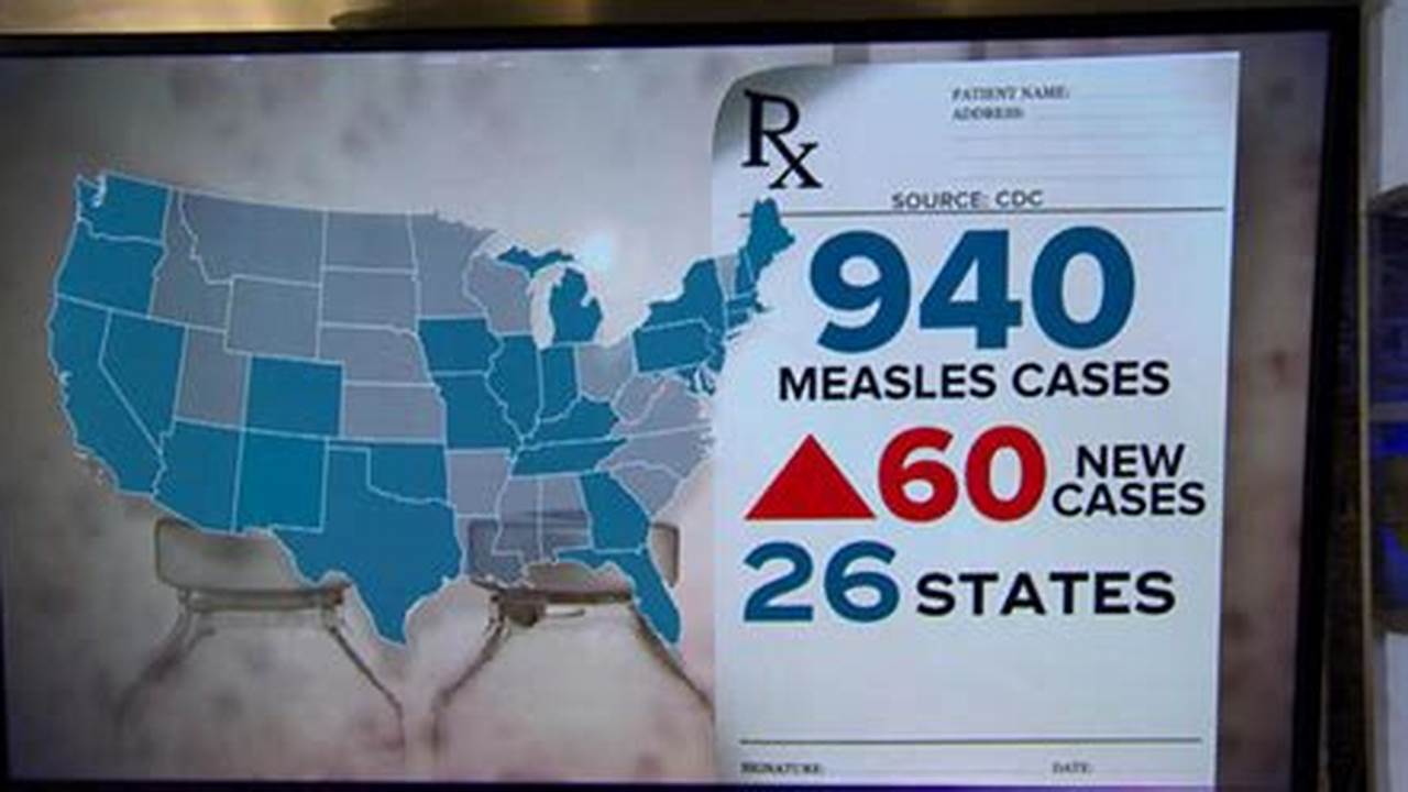 Measles Outbreak Chicago 2024 Update
