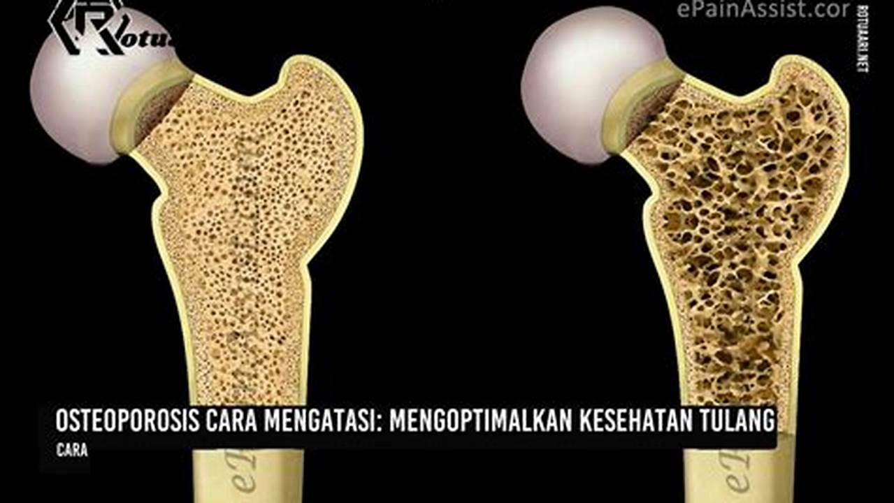 Membantu Mengatasi Osteoporosis, Manfaat