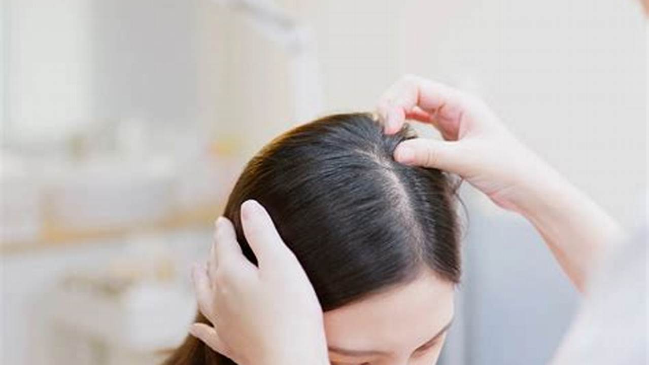 Menjaga Kesehatan Kulit Kepala, Penyubur Rambut