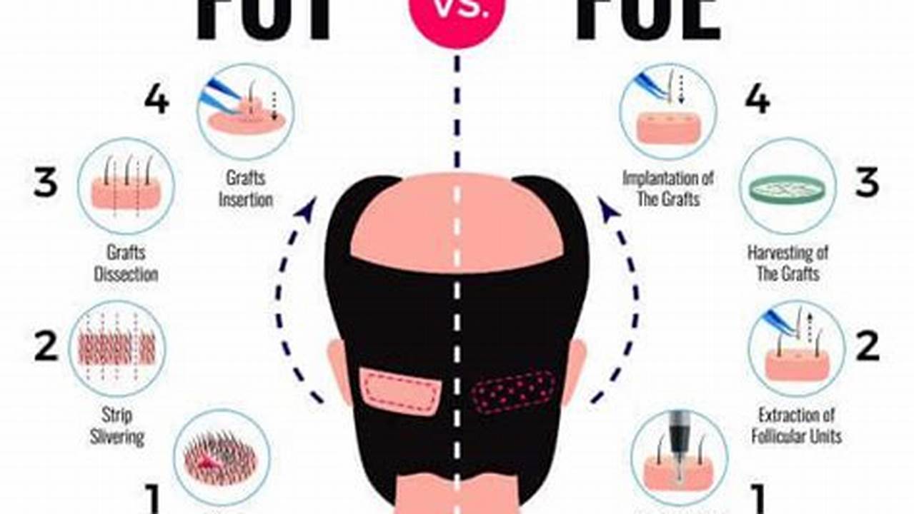 New Hair Transplant Technology 2024