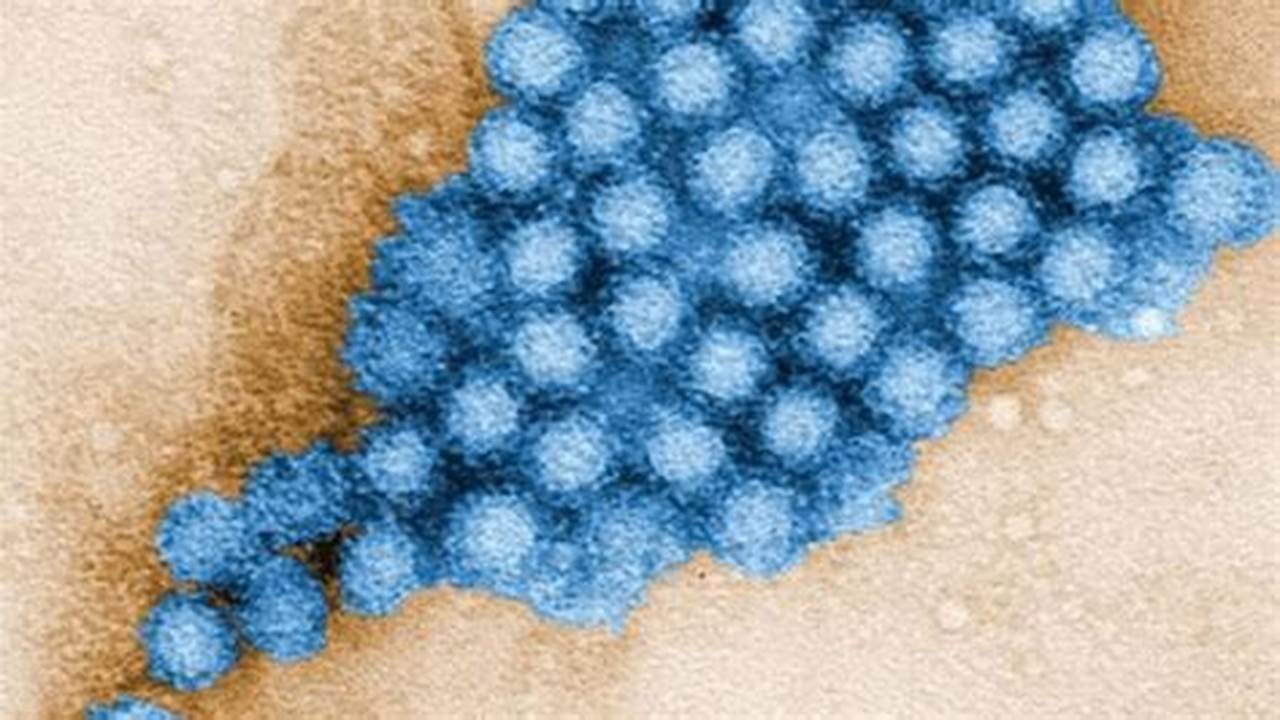 Norovirus, The Culprit Behind A Nasty Stomach Bug, Is Rising Again In Canada., 2024