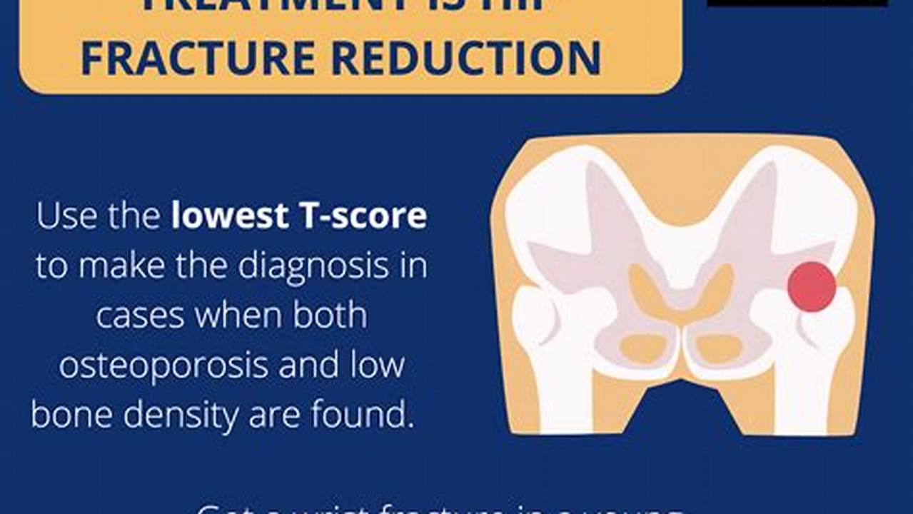 Osteoporosis Update For Primary Care, 2024
