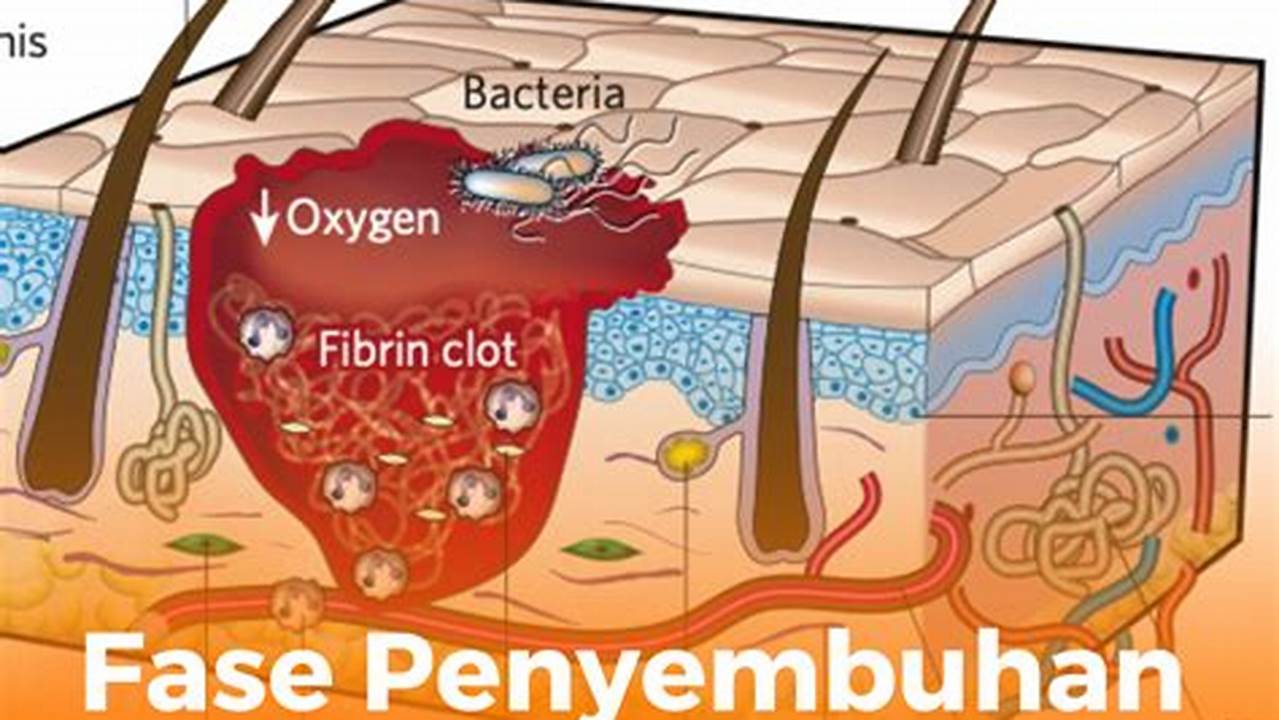 Penyembuhan Luka, Resep3