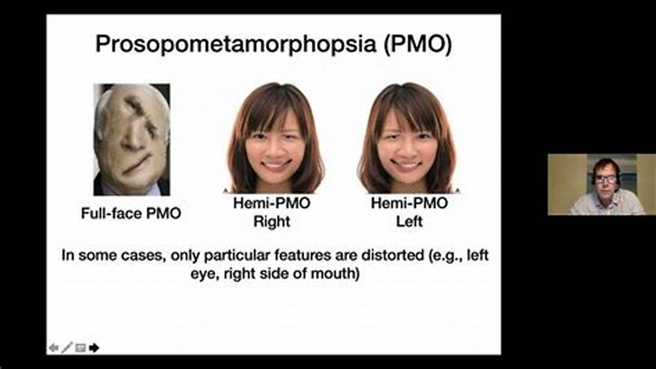 Prosopometamorphopsia Symptoms