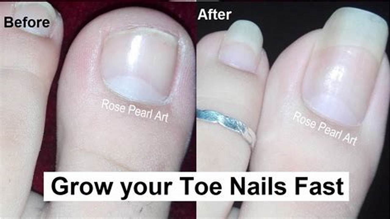 So If You Happen To Be Going On A Healthy Nail Journey In The Coming Months., 2024