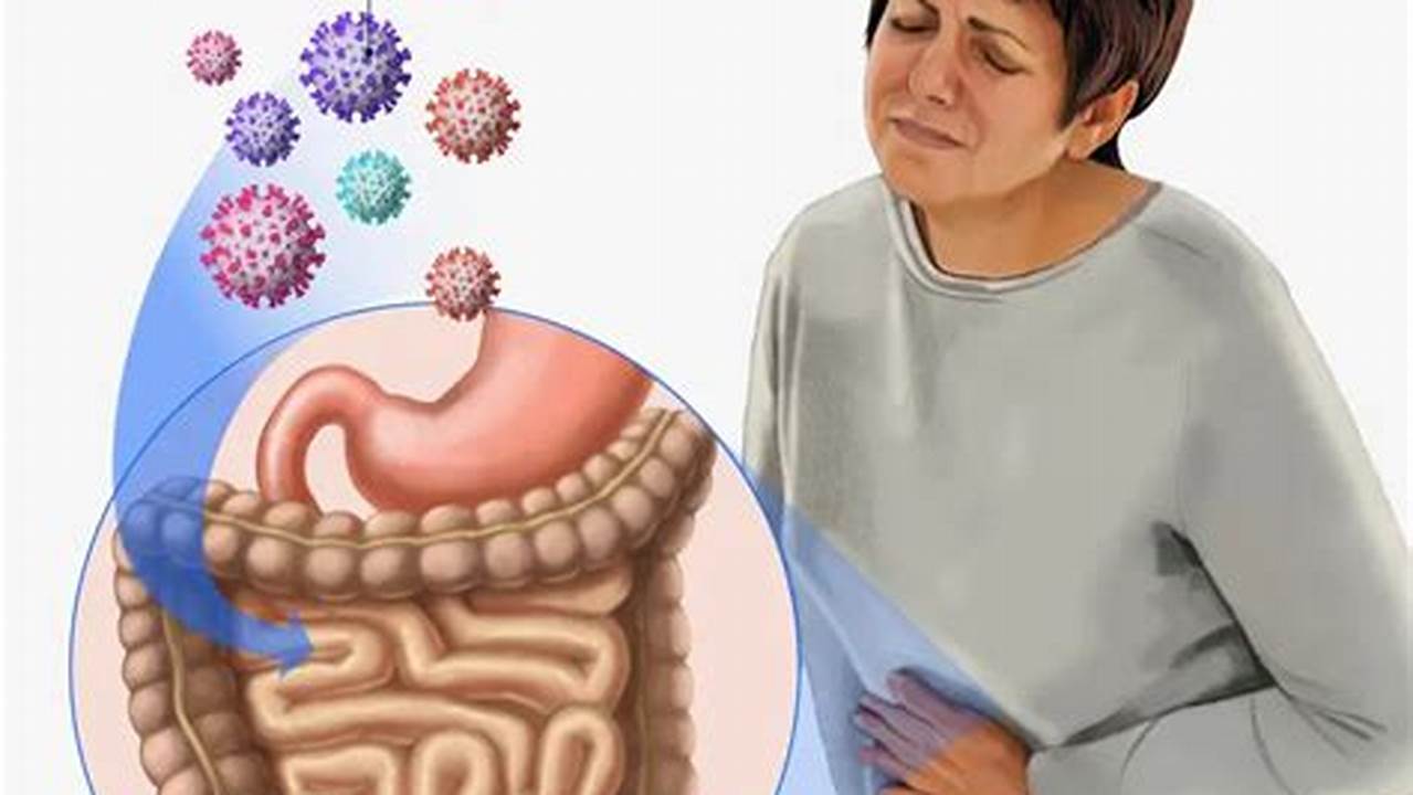 The Stomach Flu (Norovirus) Is An Acute Form Of Gastroenteritis, Or Inflamed Stomach Or Intestinal Lining Caused By A Virus, Bacteria Or Parasite., 2024