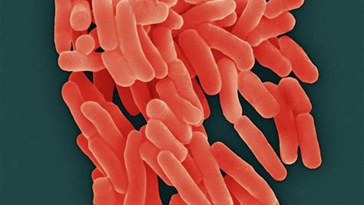 Ungkap 5 Manfaat Bakteri Thiobacillus Ferrooxidans yang Jarang Diketahui
