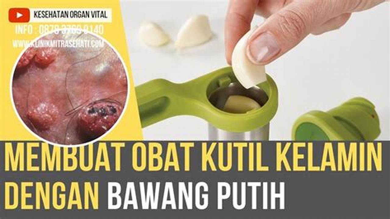 Cara Ampuh Hilangkan Kutil Kemaluan dengan Bawang Putih