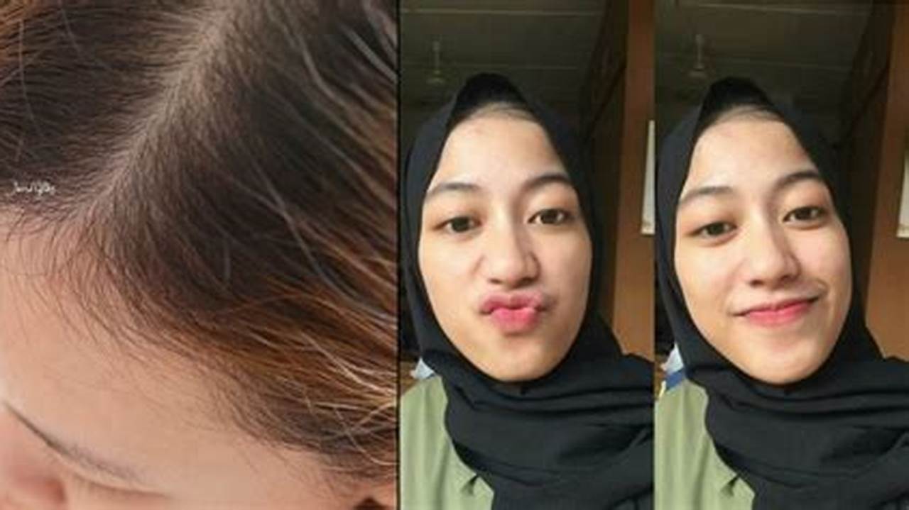 Rahasia Terungkap: Cara Menumbuhkan Rambut Anak di Dahi yang Menakjubkan