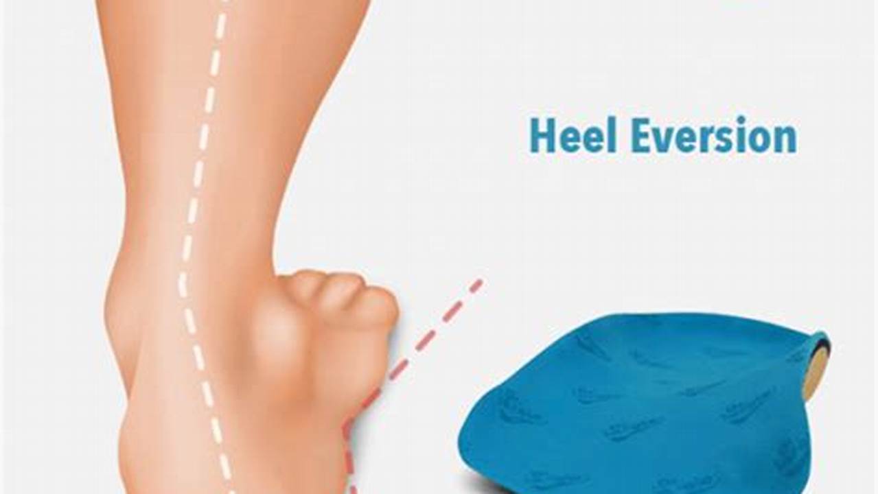 What is Everted Heel?