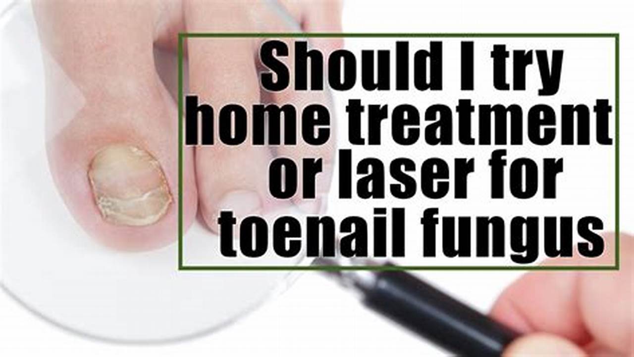 Home Laser Nail Fungus Treatment