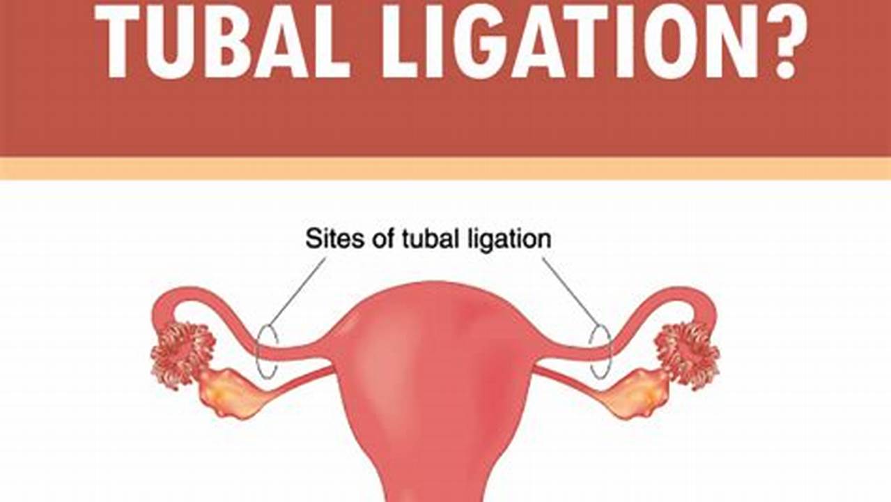 How To Get Pregnant After Having A Tubal Ligation
