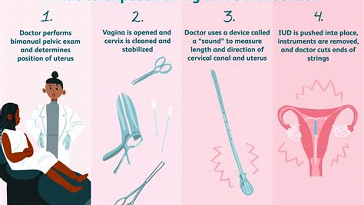 How To Get Pregnant On Birth Control Iud