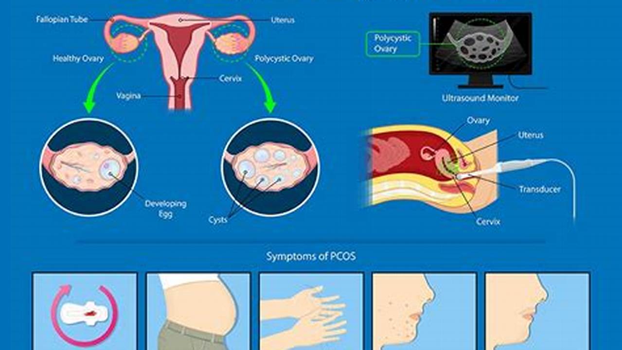 How to Get Pregnant with Polycystic Ovary Syndrome: Tips for Hope and Success