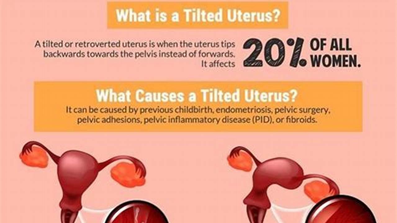 Get Pregnant with a Retroverted Uterus: Tips and Strategies for Success