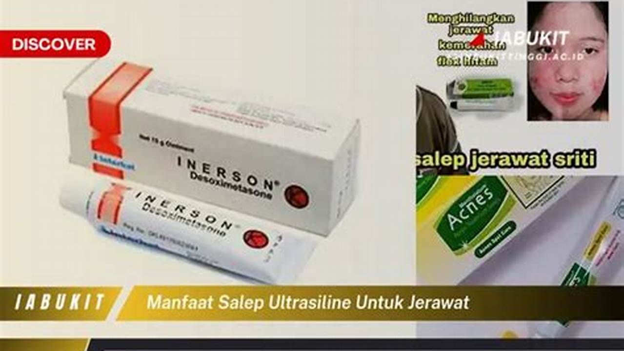 Temukan Rahasia Salep Ultrasiline untuk Jerawat