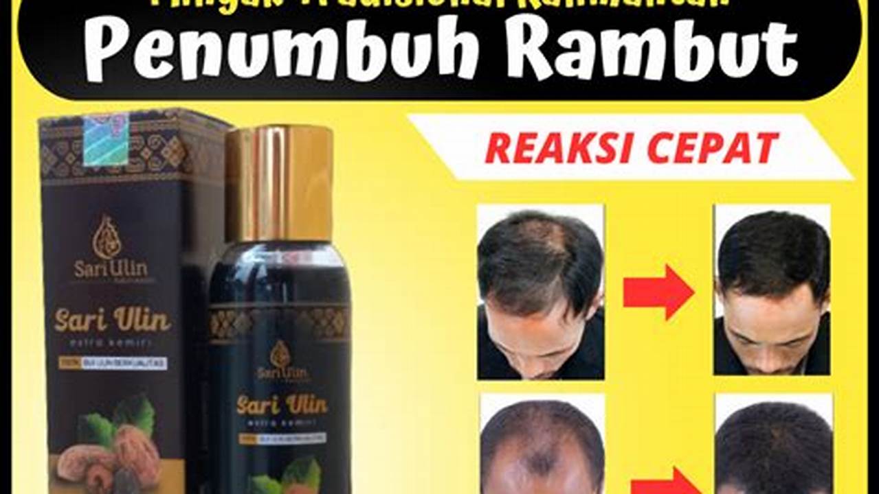 Panduan Lengkap Minyak Penumbuh Rambut Botak: Rahasia Rambut Lebat dan Sehat