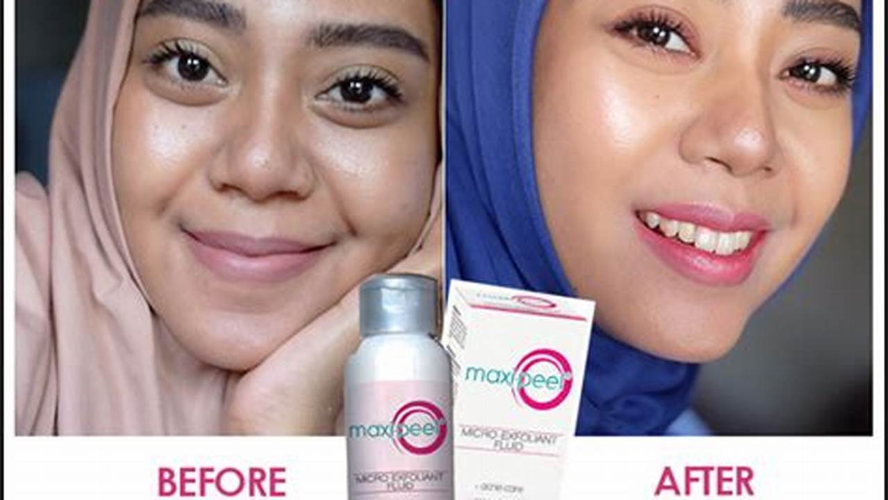 Perbedaan Maxi Peel Pink dan Hijau: Panduan Eksfoliasi untuk Kulit Sehat