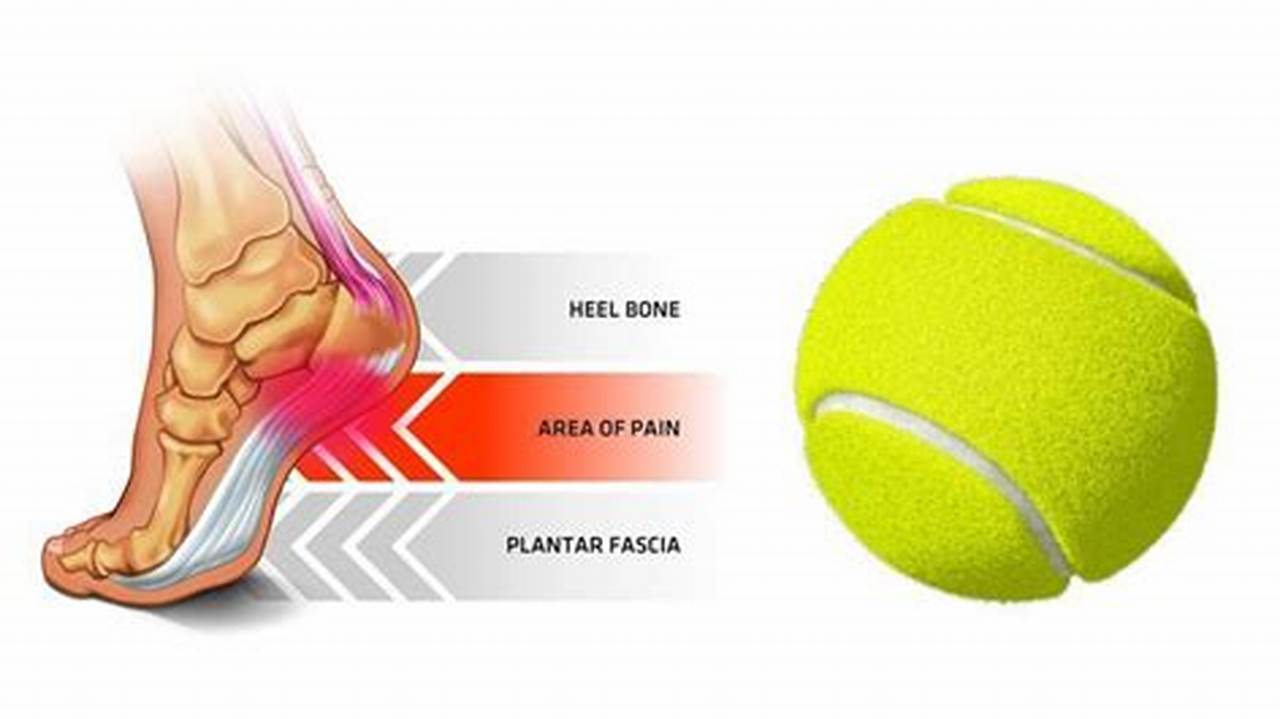 Tennis Heel Pain: Causes, Symptoms, and Treatment