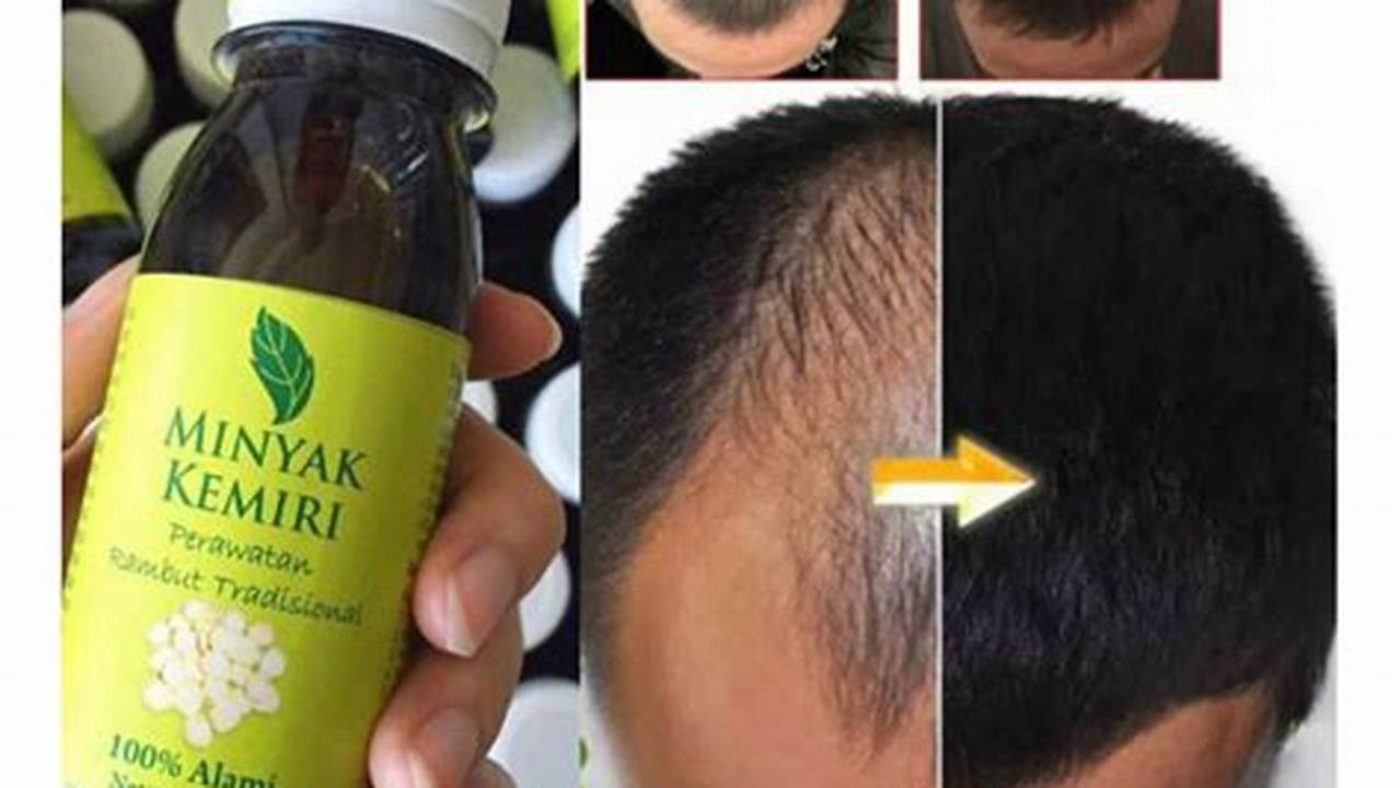 Rahasia Rambut Lebat dan Sehat: Temukan Vitamin Penyubur Rambut yang Ampuh!
