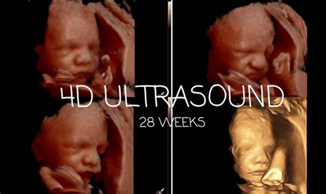 Unveiling Your Baby's World: A Guide to 28 Weeks 3D Ultrasound Pictures