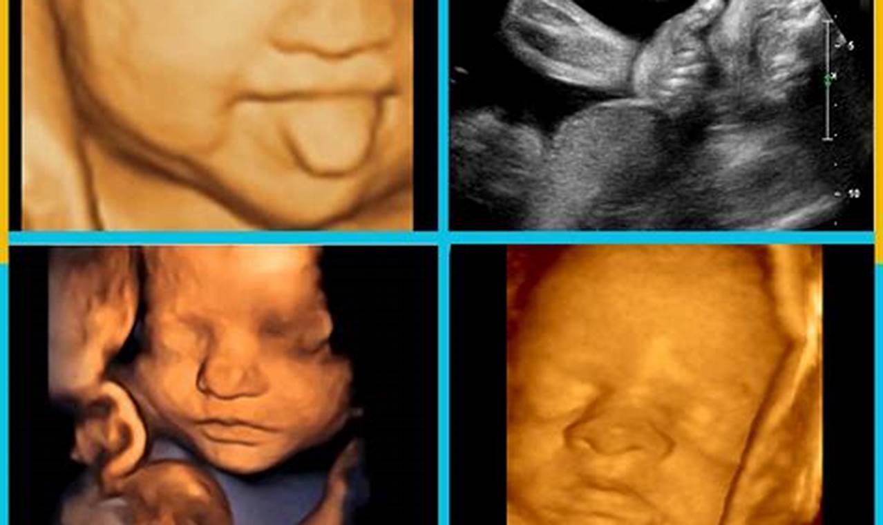 29 Weeks Pregnant Ultrasound 3D: A Comprehensive Guide for Parents
