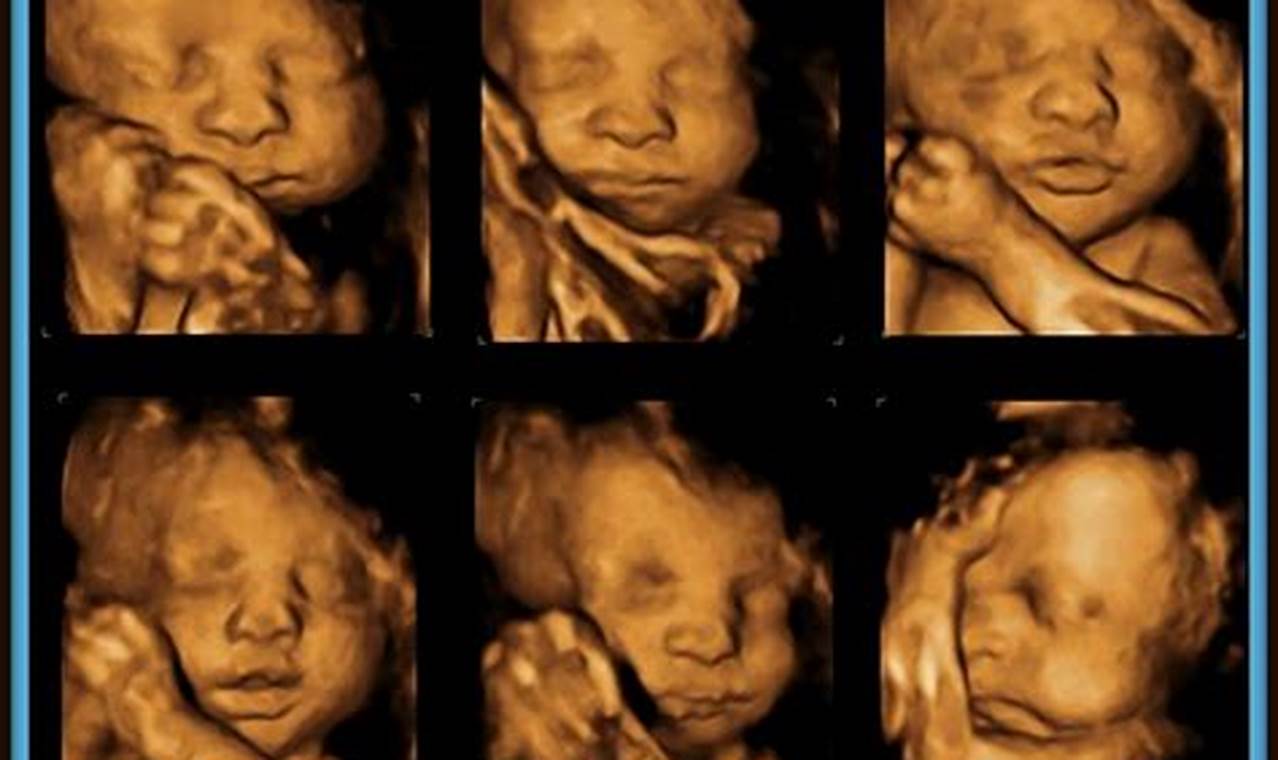 Revealing Your Baby's World: The Ultimate Guide to 30-Week Pregnant Ultrasound 3D