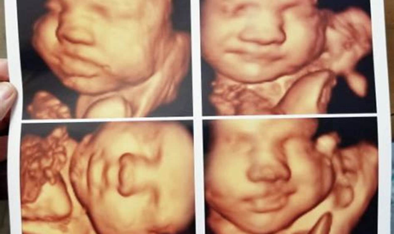 Unlock Your Baby's World with 3D Ultrasound Pictures at 32 Weeks