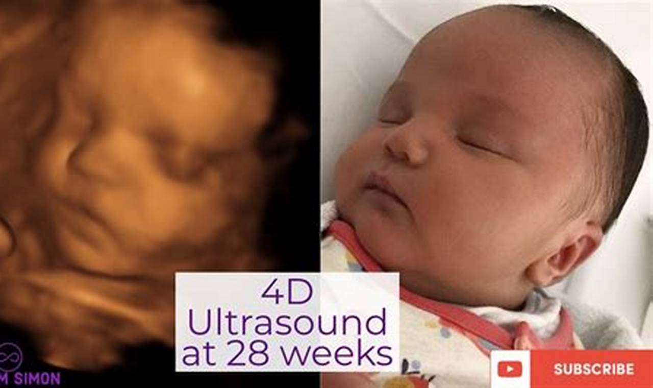 4D Ultrasound 28 Weeks: A Comprehensive Guide for Expectant Parents