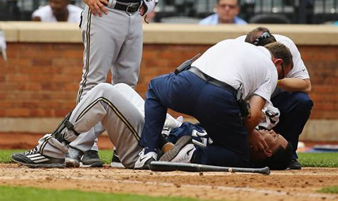 Baseball Player Hit In Face 2024