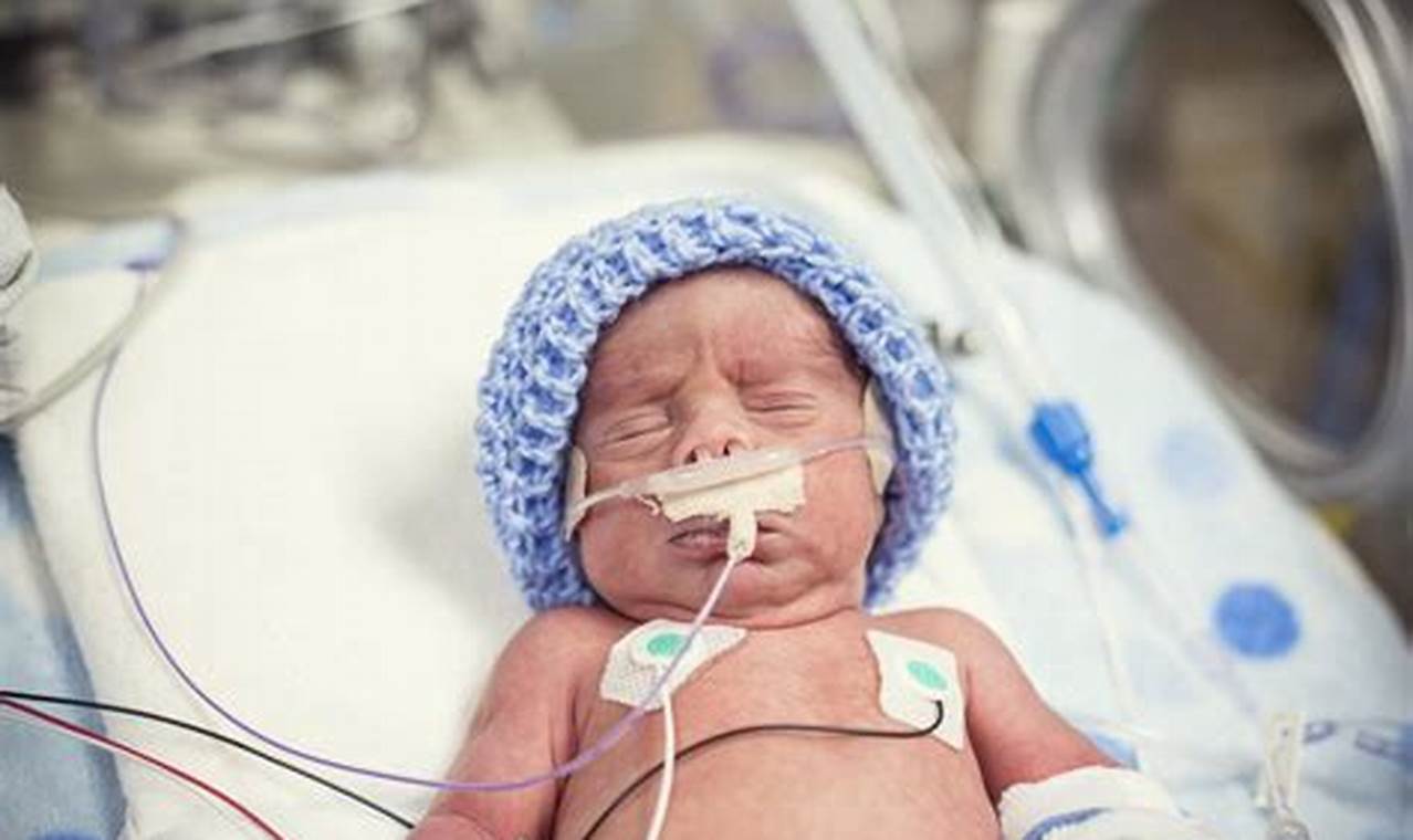 Rahasia Bayi Prematur: Penemuan dan Wawasan yang Mengubah Segalanya