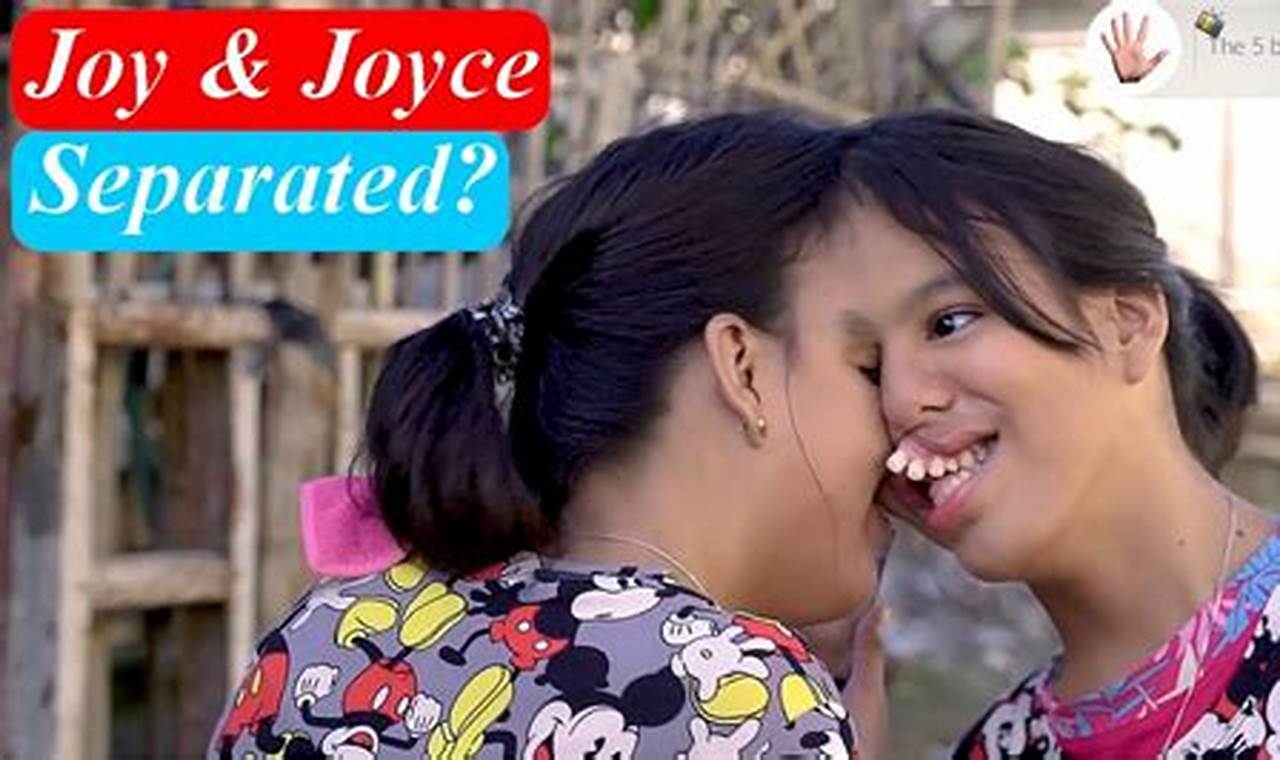 Joy And Joyce Conjoined Twins 2024 Separated