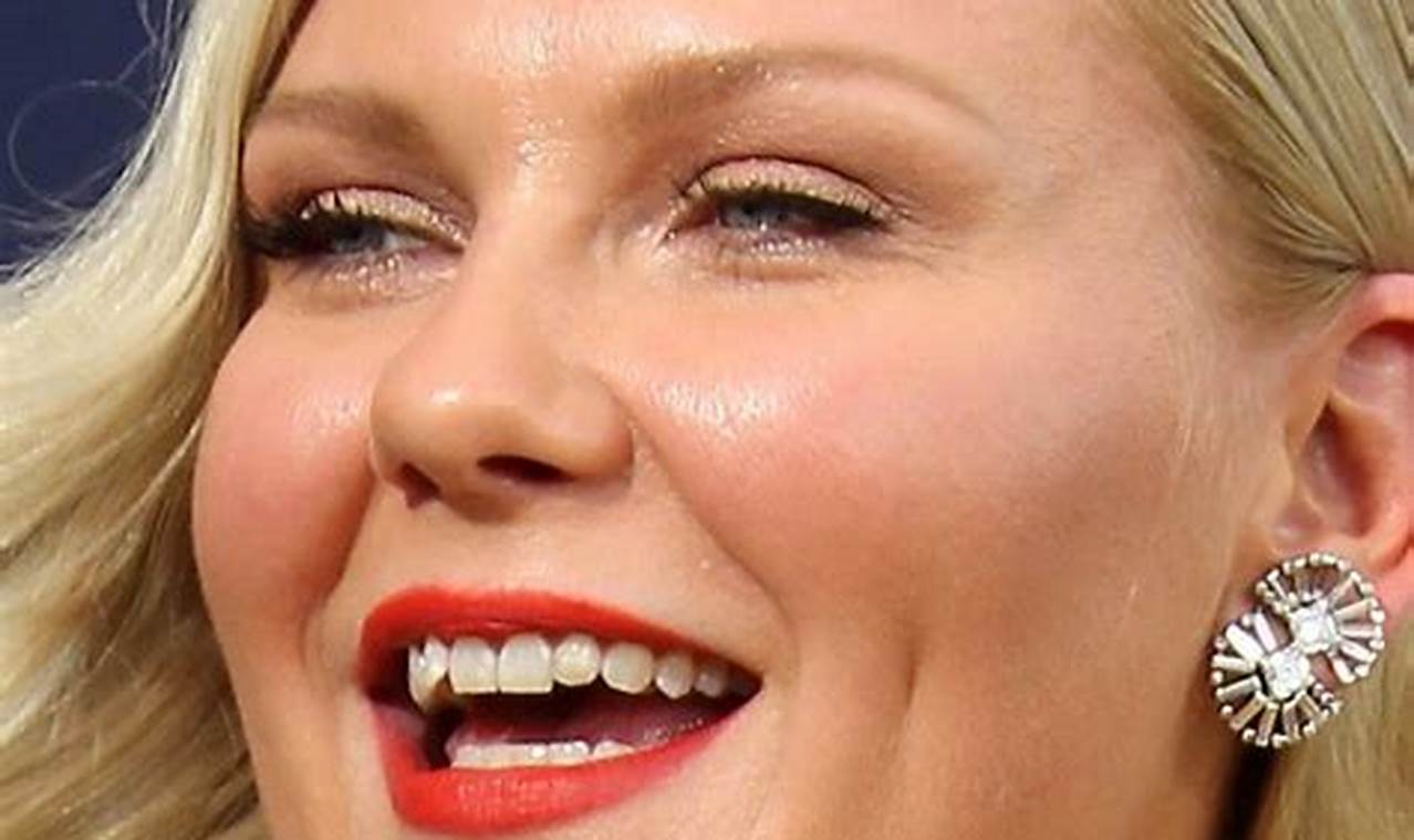 Kirsten Dunst Fixed Her Teeth
