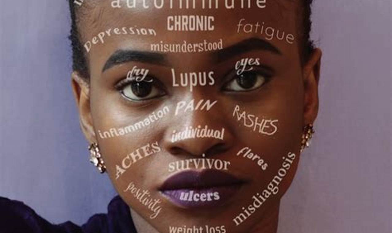 Lupus Awareness Month 2024 Uk