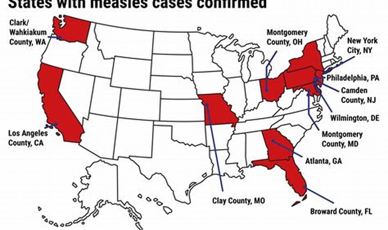 Measles Outbreak 2024 Maryland