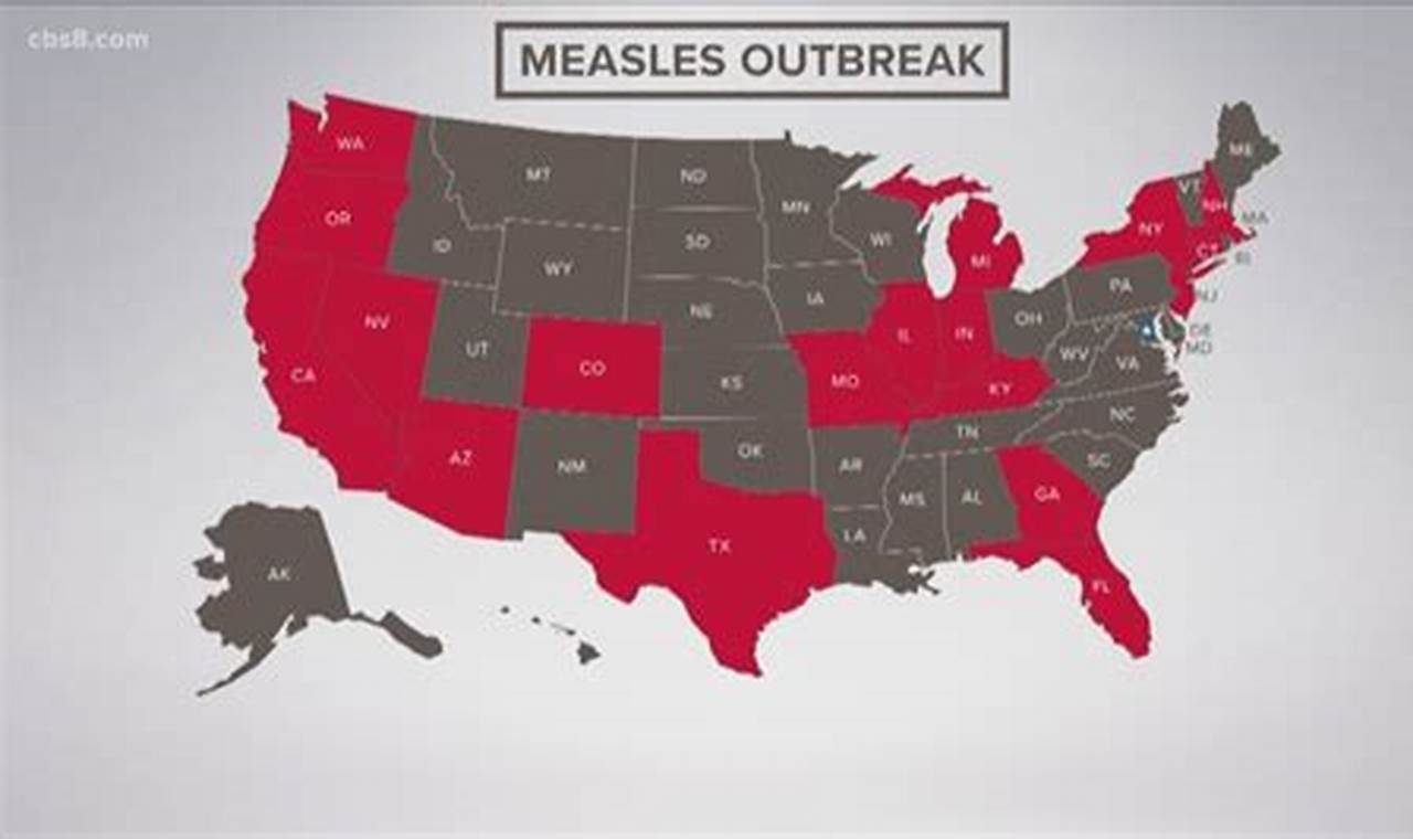 Measles Outbreak 2024 Us