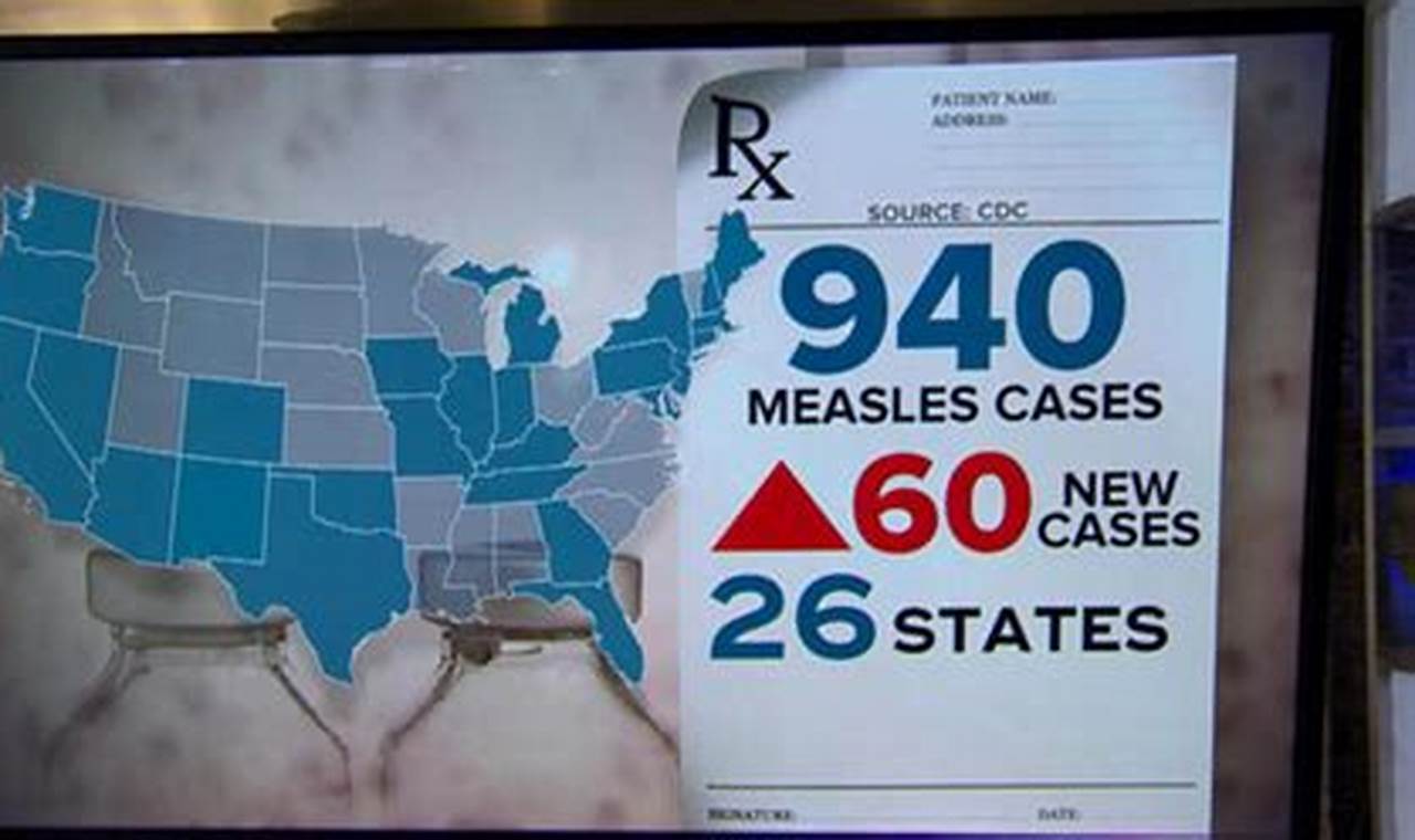 Measles Outbreak Chicago 2024 Update