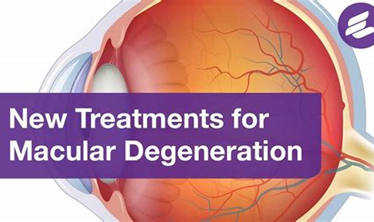 New Treatment For Dry Macular Degeneration 2024