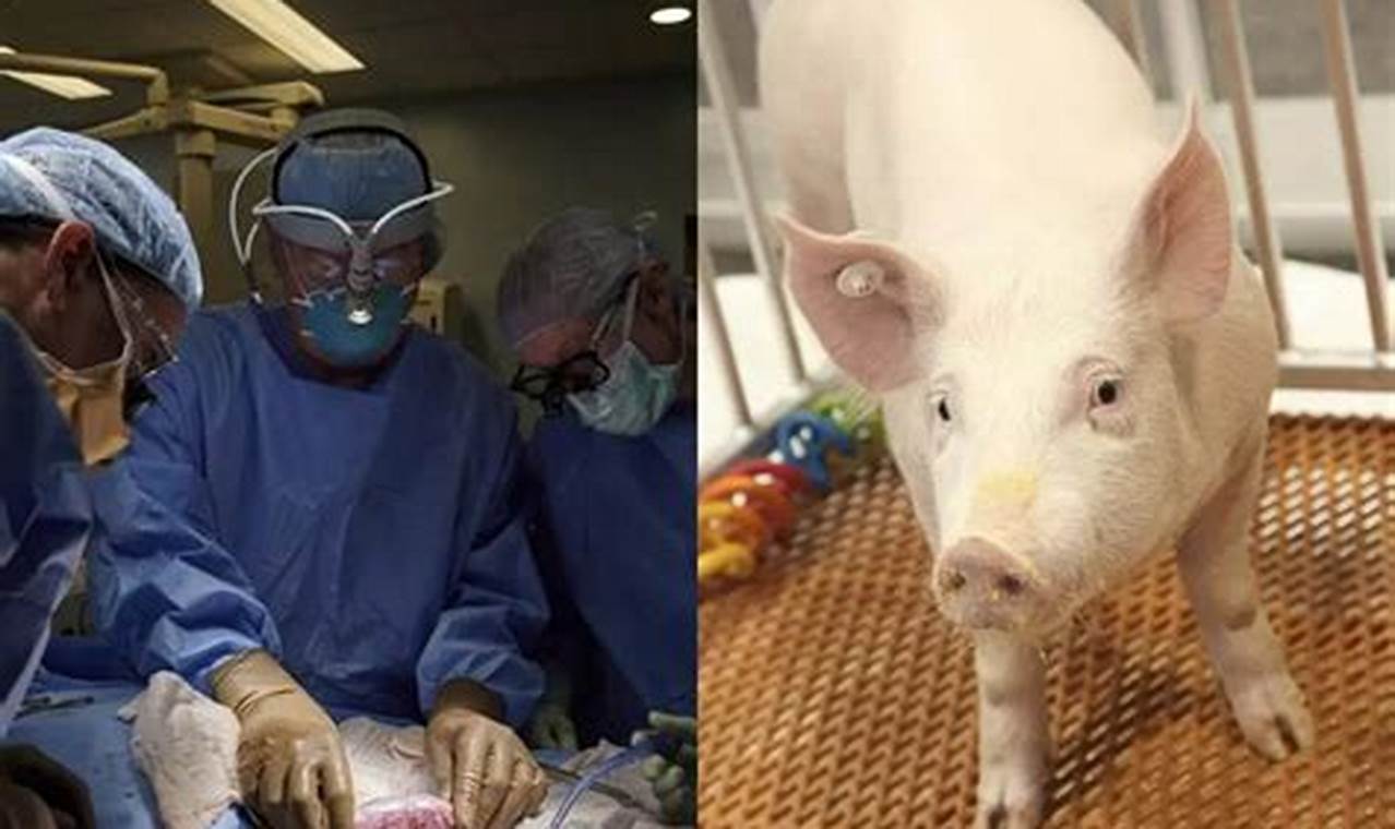Pig Kidney Transplant To Human News