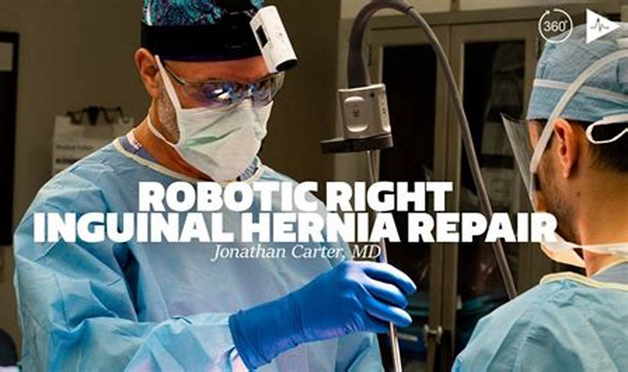 Robotic Inguinal Hernia Repair Cpt Code 2024