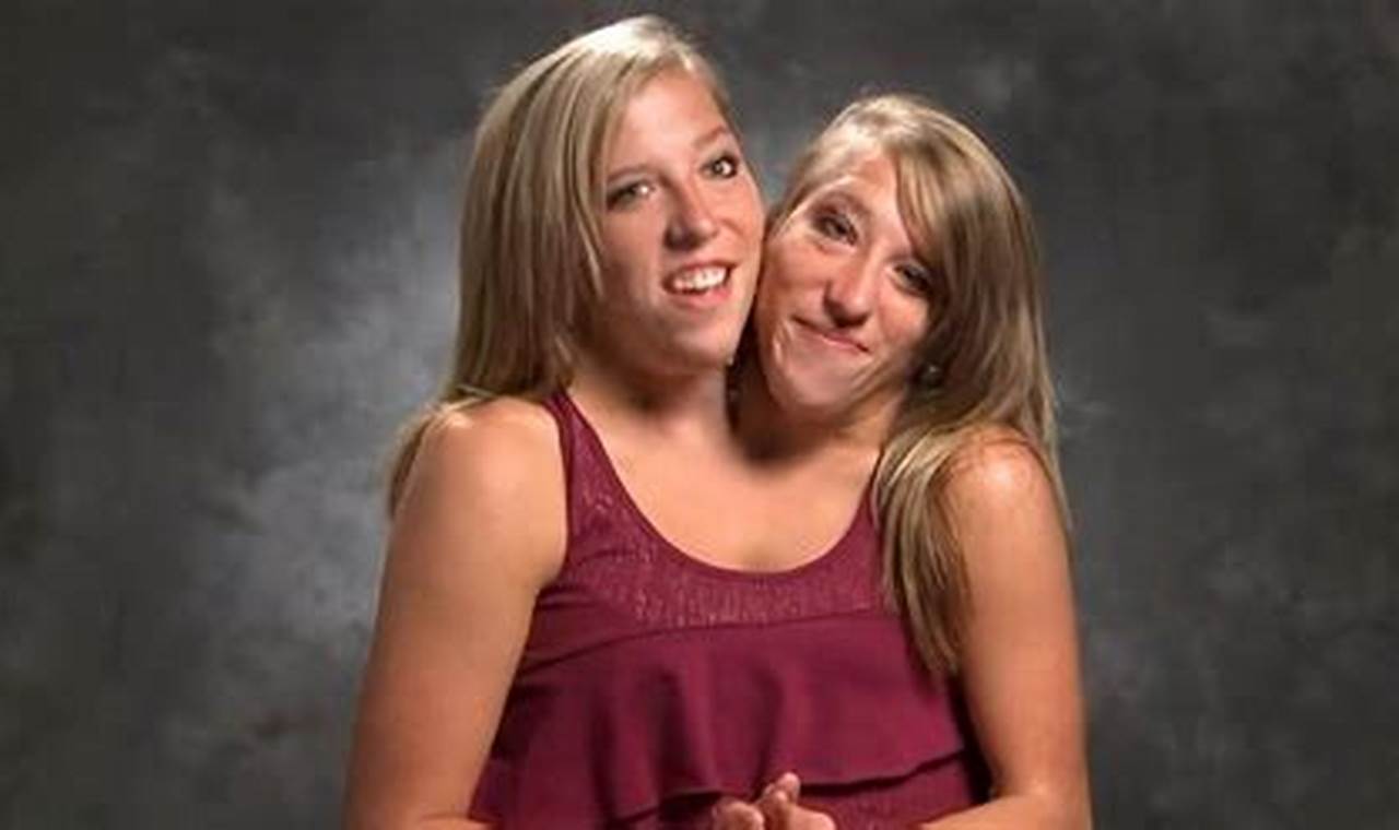 Tlc Conjoined Twins Abby And Brittany