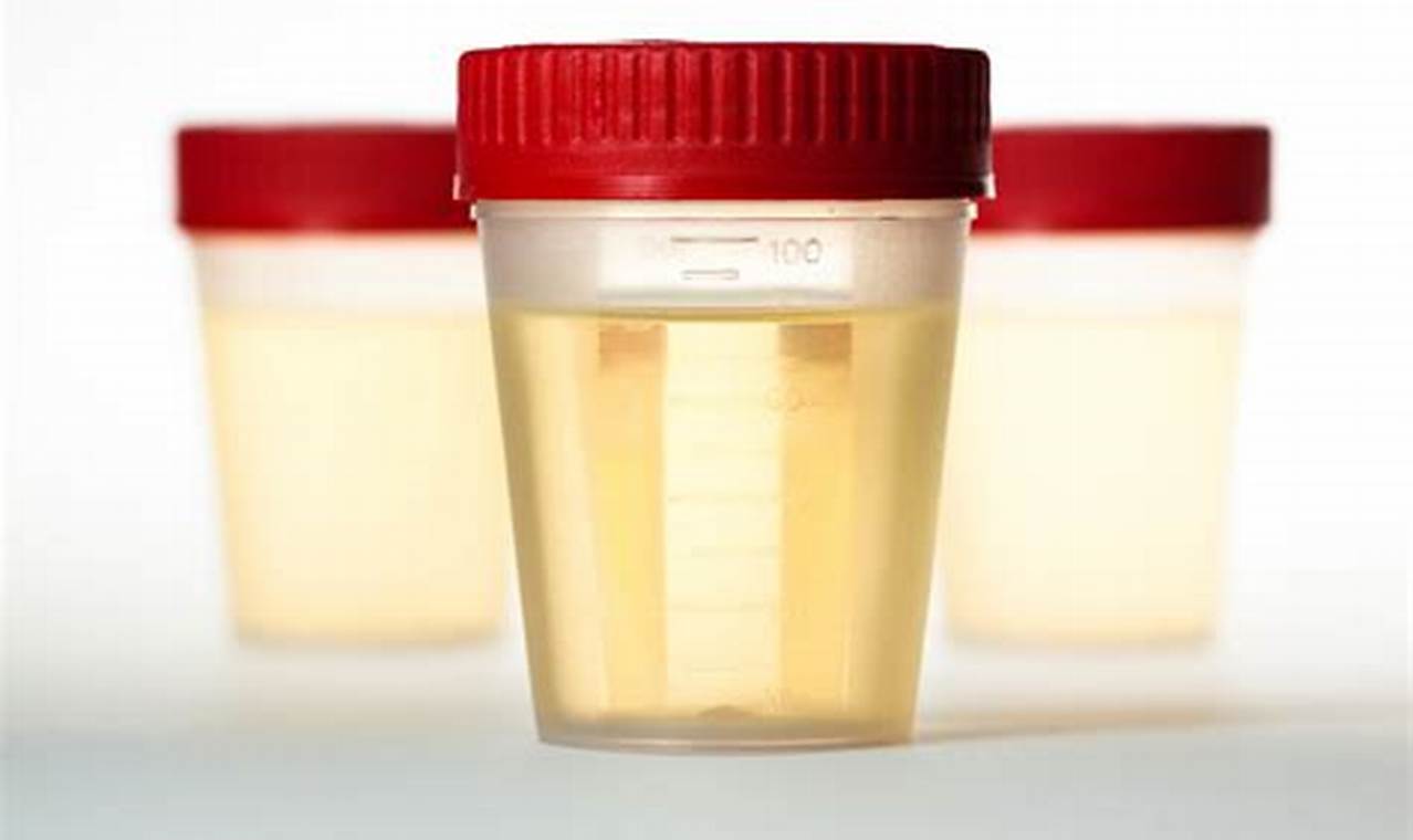 Urine Specimen Collection Guidelines 2024