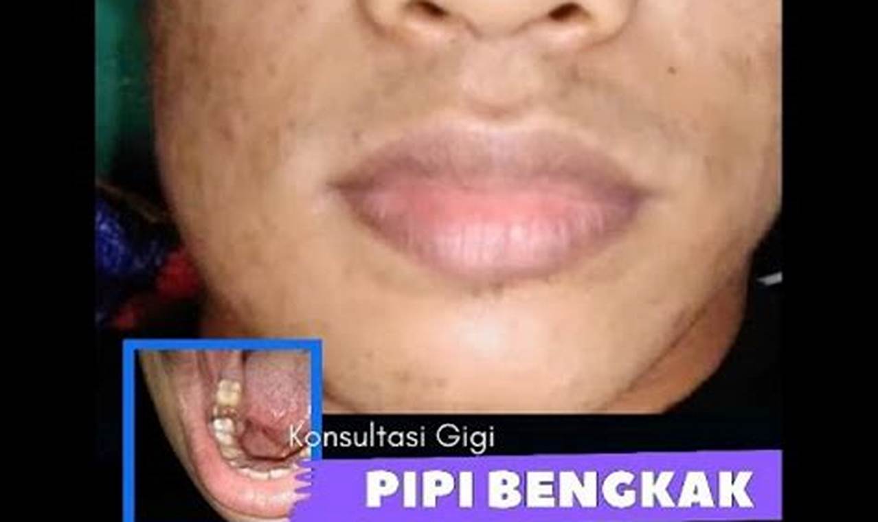 Rahasia Mengempeskan Pipi Bengkak Akibat Sakit Gigi, Dijamin Ampuh!