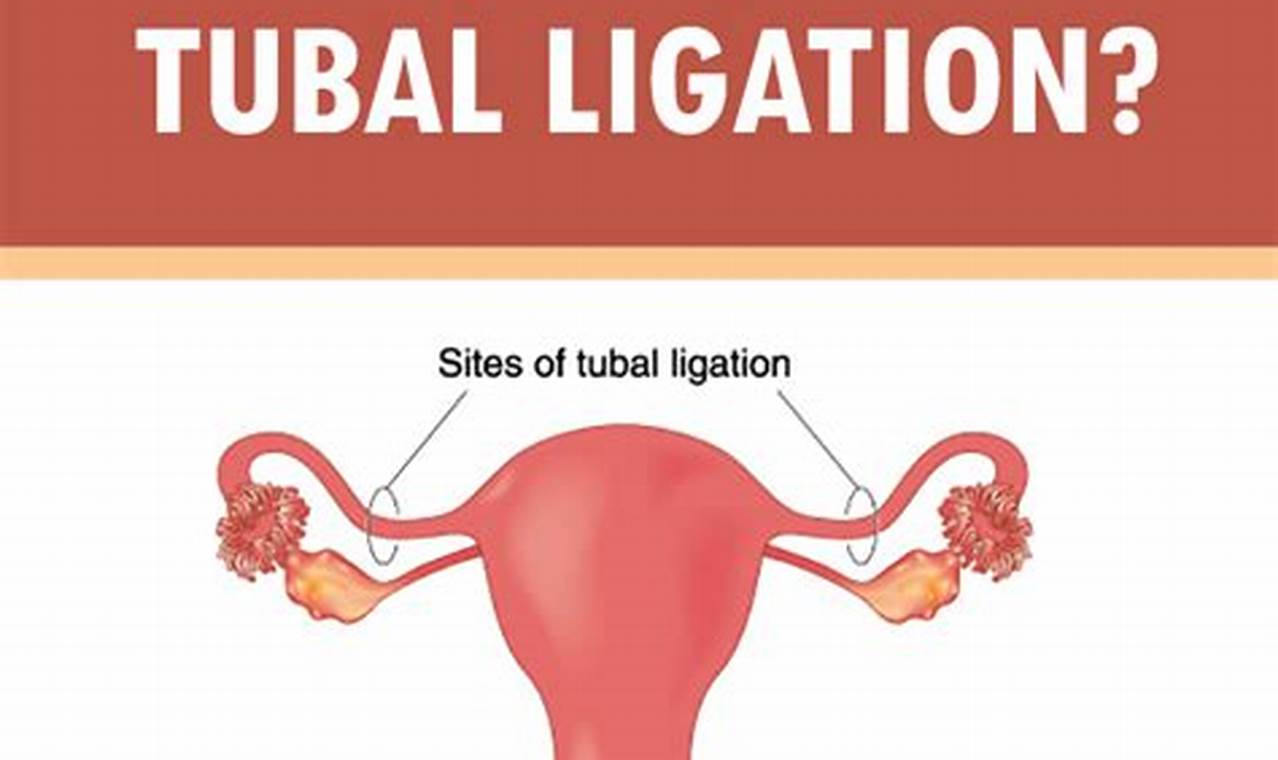 How Do You Get Pregnant With Tubal Ligation