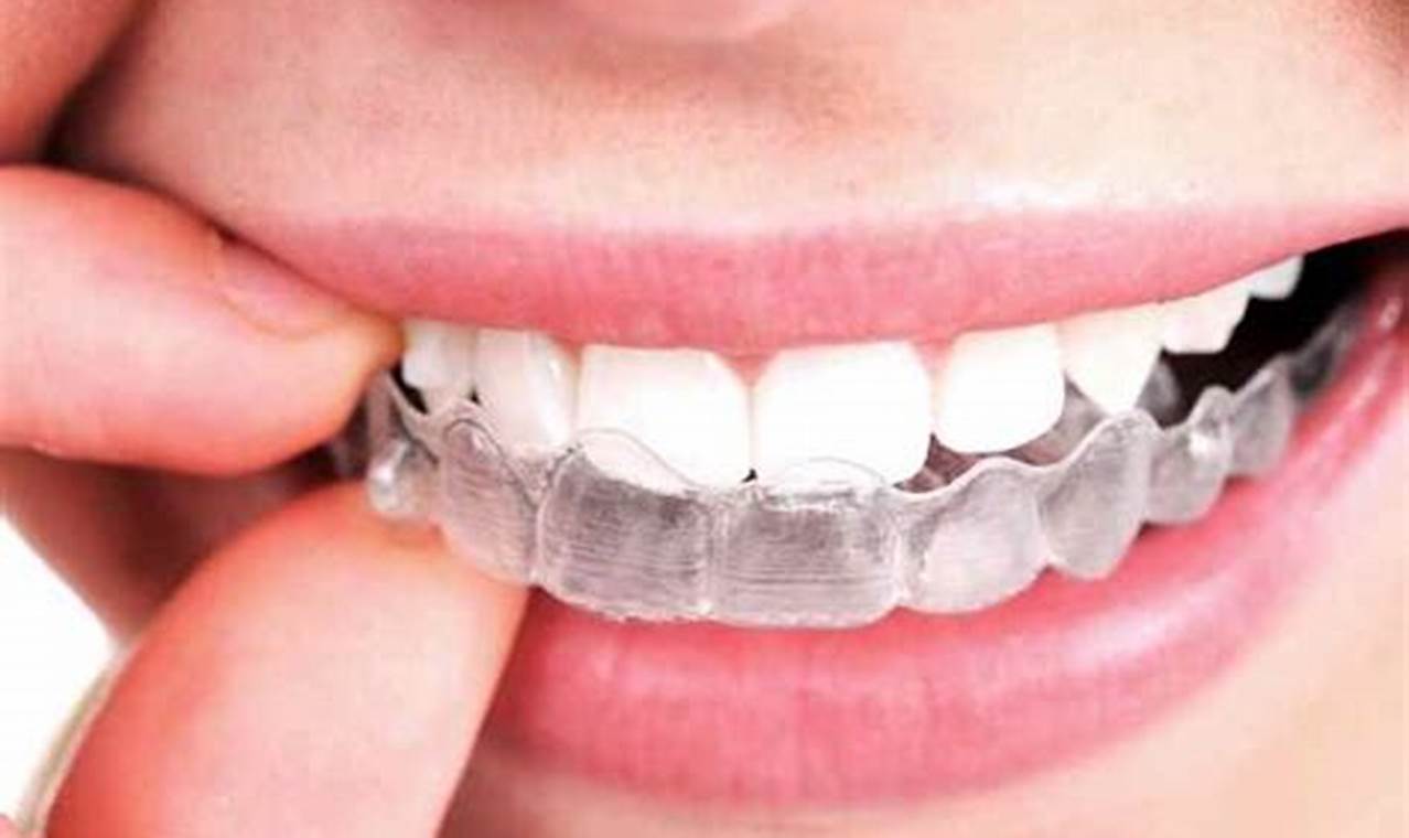 invisalign covered by insurance