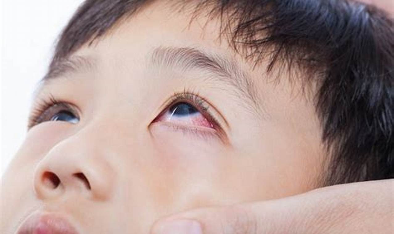 Waspada! Keluhan Mata Gatal Akibat Alergi, Jangan Disepelekan