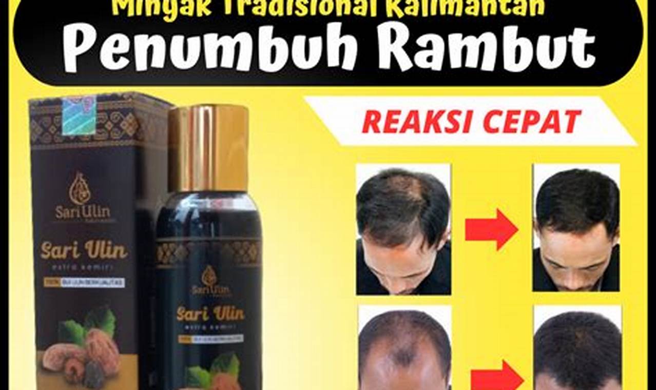 Panduan Lengkap Minyak Penumbuh Rambut Botak: Rahasia Rambut Lebat dan Sehat