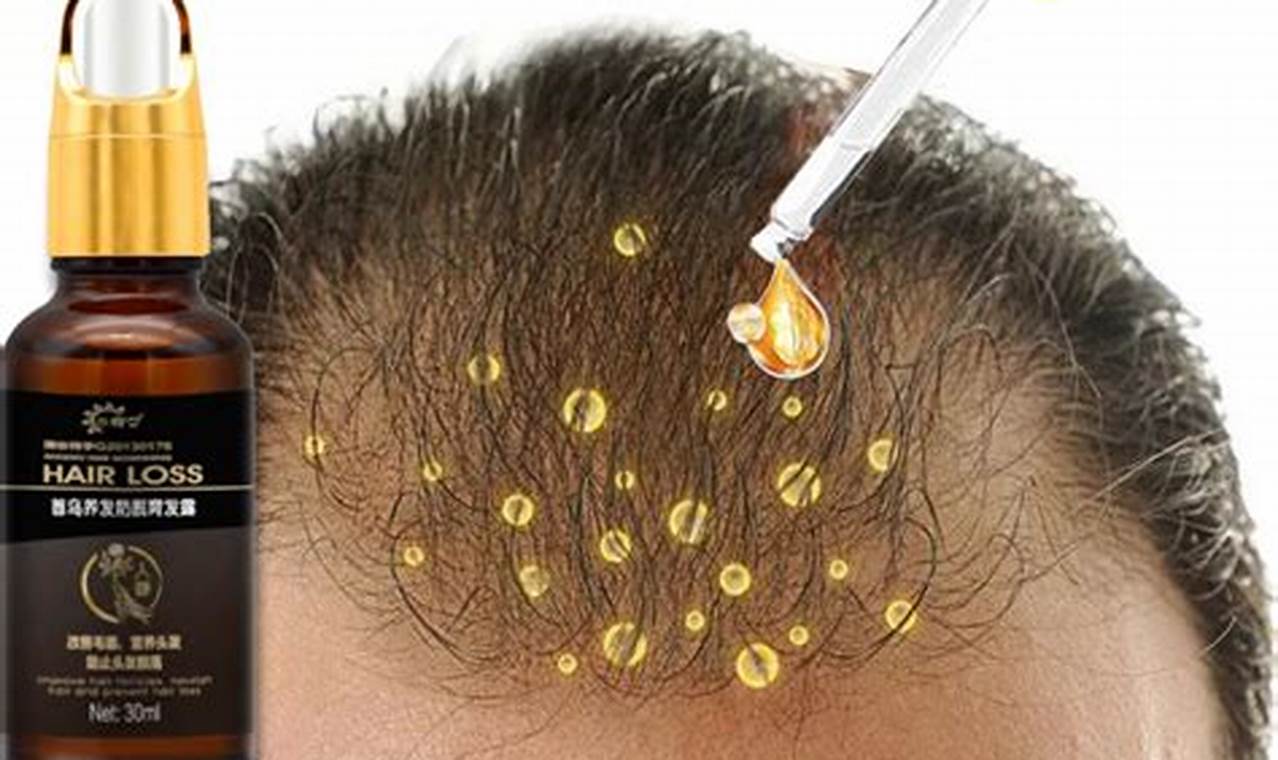 Rahasia Rambut Tebal dan Berkilau: Panduan Serum Penumbuh Rambut Cepat